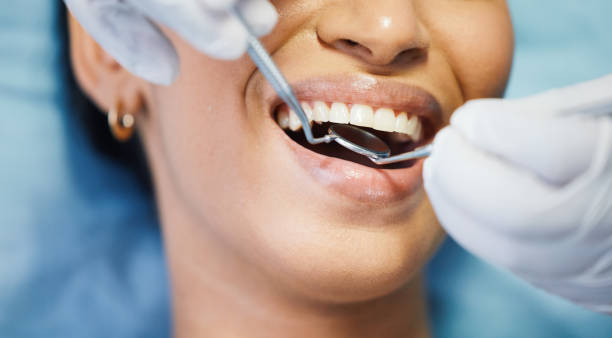 Best Emergency Tooth Extraction in Lake Royale, NC